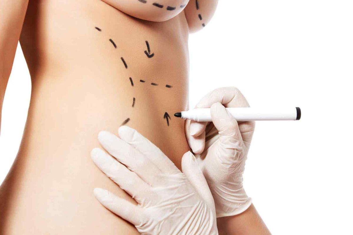 cosmetic-surgery-blog-11-1200x800.jpg